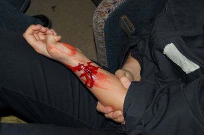 Pressefoto: , 2008 © Die DRK schminkte die Verletzten für dir Verletzungen, wie hier mit einer offenen Wunde am Unterarm